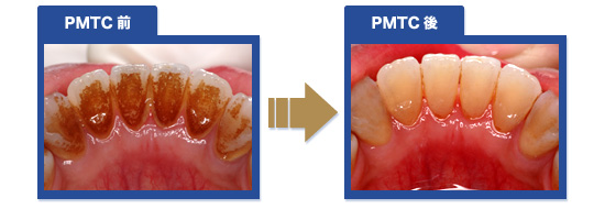 PMTC�{�p�O�y�ю{�p��